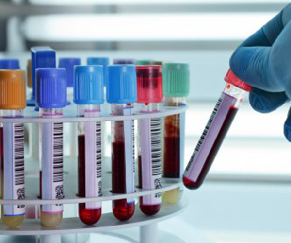 Perfiles de laboratorio